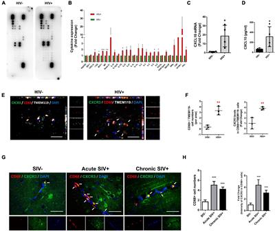 HIV Tat-Mediated Induction of Monocyte Transmigration Across the Blood–Brain Barrier: Role of Chemokine Receptor CXCR3